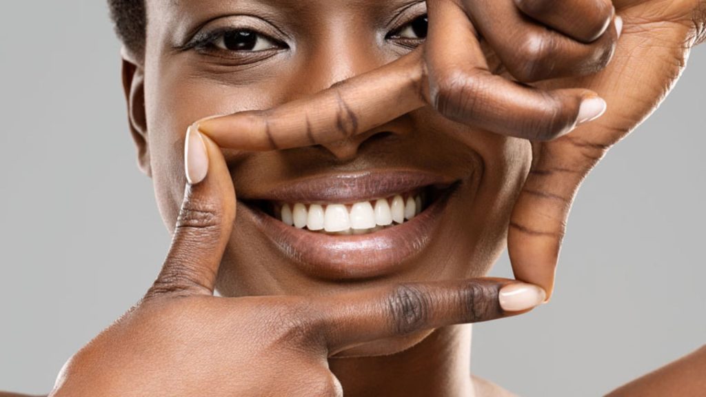 Thinking About Professional Teeth Whitening? Here’s What to Expect