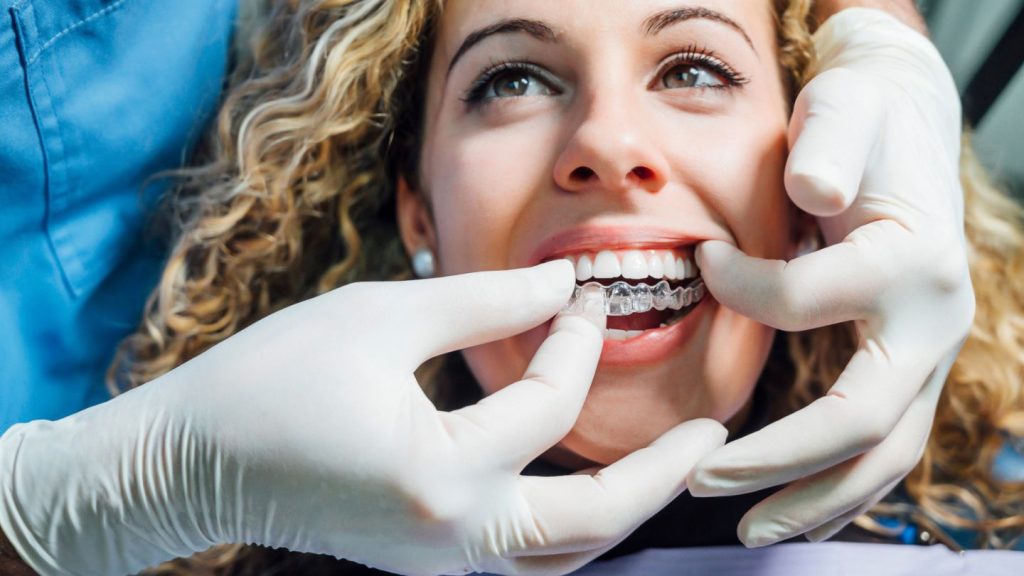 Simple Tips for Keeping Your Clear Aligners Crystal Clear